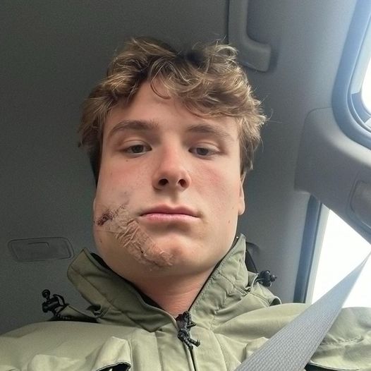 Billede fra Frederikshavns Facebook-profil.